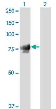 JUP/CTNNG/Junction Plakoglobin Antibody