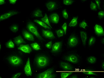 KRT81/Keratin 81/KRTHB1 Antibody