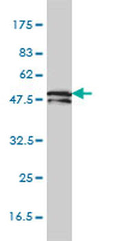 KRT81/Keratin 81/KRTHB1 Antibody