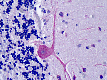 OSBPL1A/ORP1 Antibody