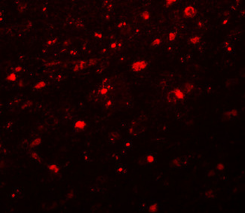 CCDC88A/GIV/Girdin Antibody
