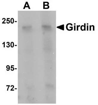 CCDC88A/GIV/Girdin Antibody