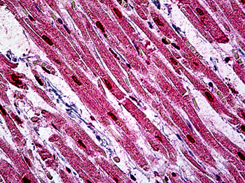 LBR/Lamin B Receptor Antibody