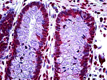 p16INK4a/CDKN2A Antibody