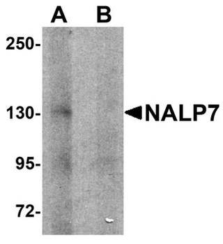NLRP7/NALP7 Antibody