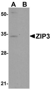 SLC39A3/ZIP3 Antibody