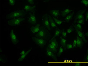 CDK6 Antibody