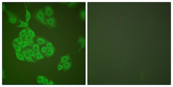 MMP11 Antibody