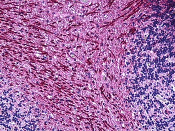 LPAR1/LPA1/EDG2 Antibody