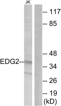 LPAR1/LPA1/EDG2 Antibody