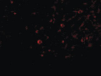 IL32 Antibody