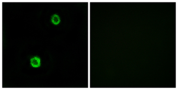 CST1/Cystatin SN Antibody