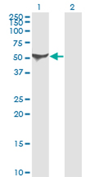 ALDH1A1/ALDH1 Antibody