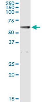 ALDH1A1/ALDH1 Antibody