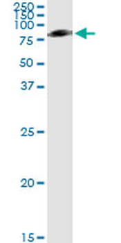 SERPING1/C1 Inhibitor Antibody