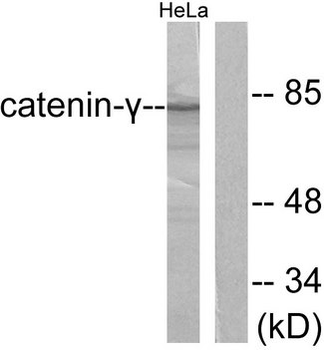 JUP/CTNNG/Junction Plakoglobin Antibody