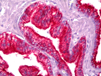 KRT18/CK18/Cytokeratin 18 Antibody (FITC)