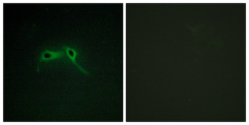 Neurofibromin/NF1 Antibody