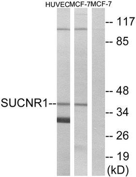 SUCNR1/GPR91 Antibody