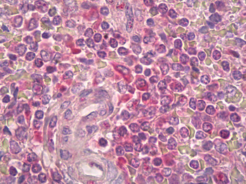 IL2RB/CD122 Antibody