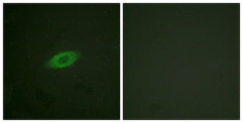 ANXA6/Annexin A6/Annexin VI Antibody
