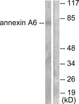 ANXA6/Annexin A6/Annexin VI Antibody