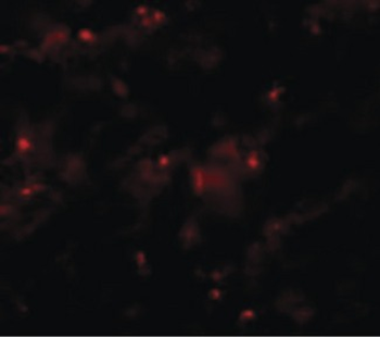 AXIN2/Axin 2 Antibody