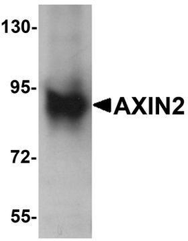 AXIN2/Axin 2 Antibody