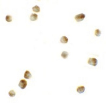Rho Kinase/ROCK1 Antibody