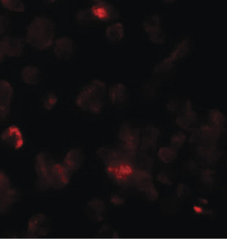Rho Kinase/ROCK1 Antibody