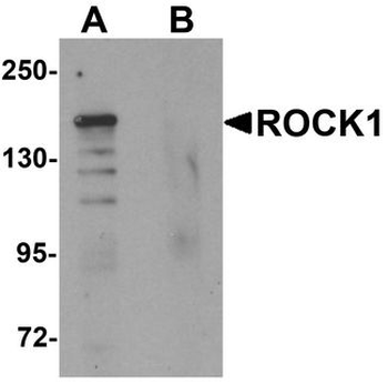 Rho Kinase/ROCK1 Antibody