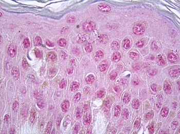 Vitamin D Receptor/VDR Antibody