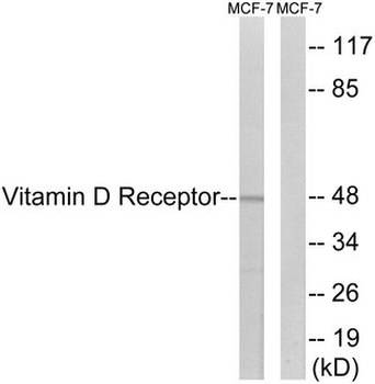 Vitamin D Receptor/VDR Antibody