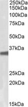 GNB3 Antibody