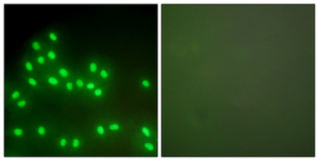 Ku70+Ku80/XRCC6+XRCC5 Antibody