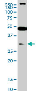 SETD7/SET7 Antibody