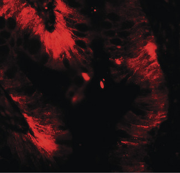 CLDN4/Claudin 4 Antibody