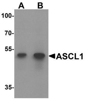FACL2/ACSL1 Antibody