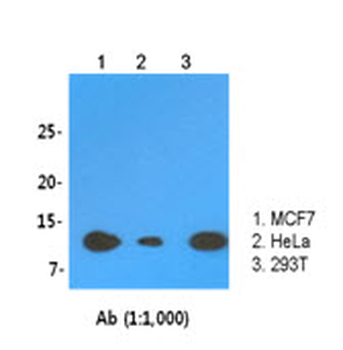 LSM2/SnRNP Antibody