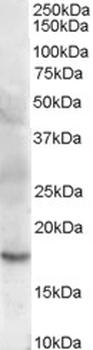 CFL2/Cofilin 2 Antibody