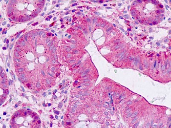 SHANK2/SHANK Antibody