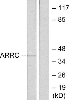 ARR3/Cone Arrestin Antibody