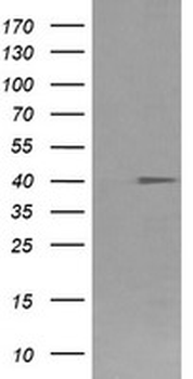 FCGR1A/CD64 Antibody