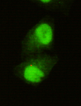 KDM5C/Jarid1C/SMCX Antibody