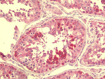 CASKIN2 Antibody