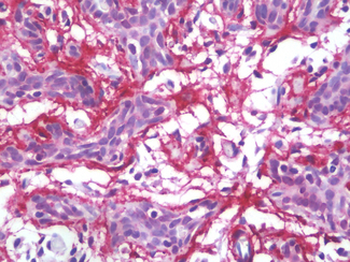 MFAP4 Antibody