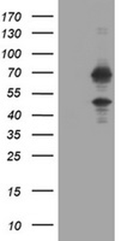 TRMT2A Antibody