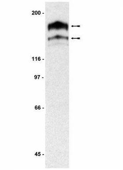 PDGFRA / PDGFR Alpha Antibody (aa1000-C-term)