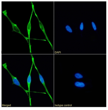 Anti-Mesothelin [11-25]