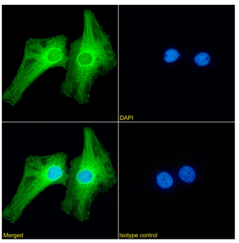 Anti-PRDM9 [RAB-C370]
